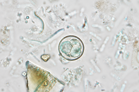 CDC microscope image of Cyclospora cayetanensis