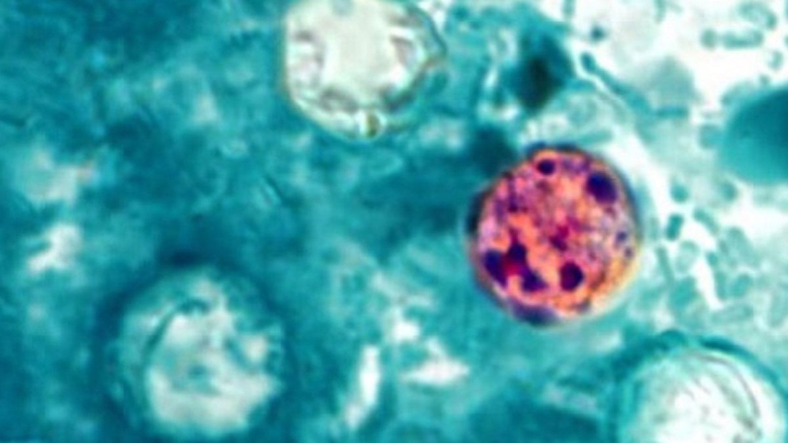 Cyclospora Outbreak Spreads Across the US: Understanding the Parasite and Its Alarming Rise