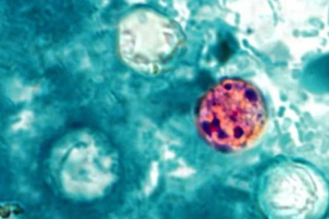 Cyclospora