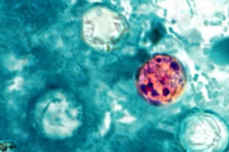 Cyclospora