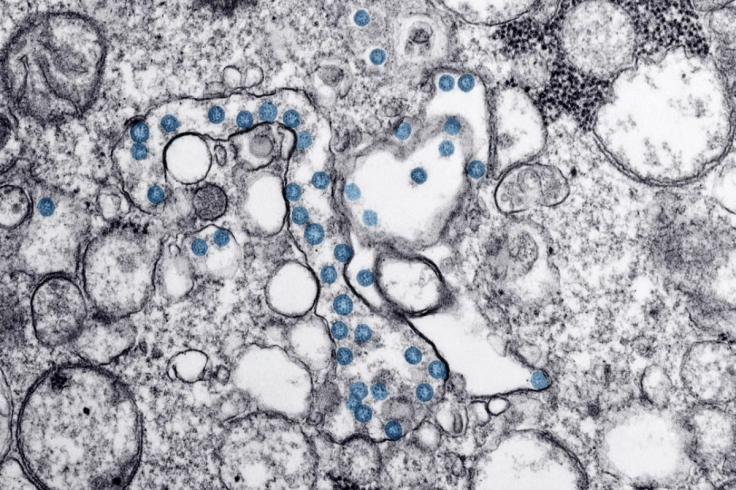 Taylor Farms and Taco Bell Cyclospora Outbreak
