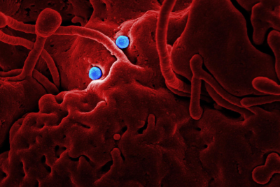 Cyclospora Warning for UK Tourists Visiting Mexico