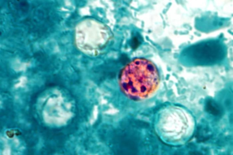 Michigan Cyclosporiasis