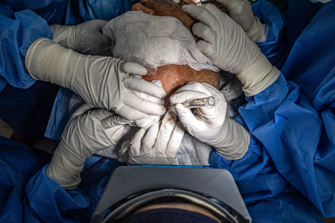 Kumamoto Earthquake Surgeons Protect Patient During Surgery