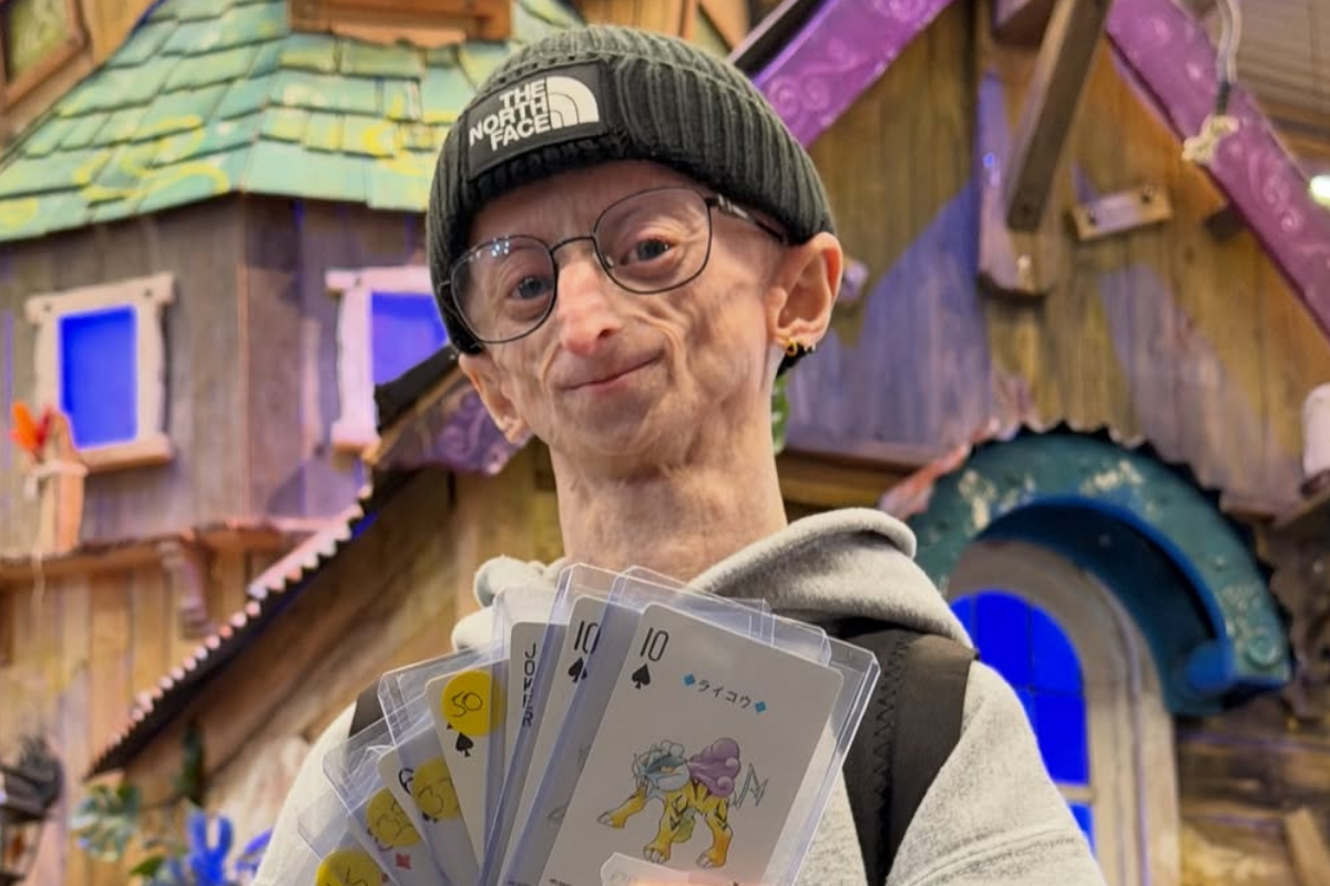 Michiel Vandeweert, Content Creator With Rare Progeria Condition