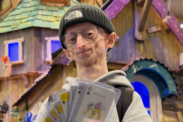 Michiel Vandeweert, Content Creator With Rare Progeria Condition