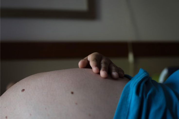 C-Section Fire Burns New Mother