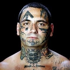 Reformed White Supremacist Has 25 Procedures To Remove Racist Tattoos photos