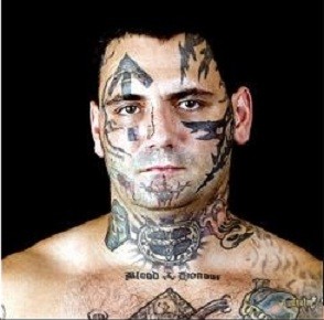 Reformed White Supremacist Has 25 Procedures To Remove Racist Tattoos Photos