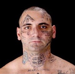 Reformed White Supremacist Has 25 Procedures To Remove Racist Tattoos