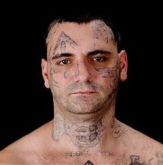 Reformed White Supremacist Has 25 Procedures To Remove Racist Tattoos