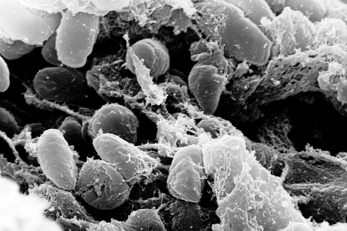 Russian Lab Siberia Plague Scare: Russia's Health Watchdog Says Lab Worker Who Died ...