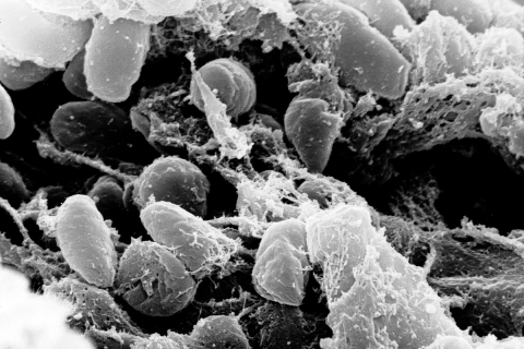 US CDC Russia Siberian plague laboratory