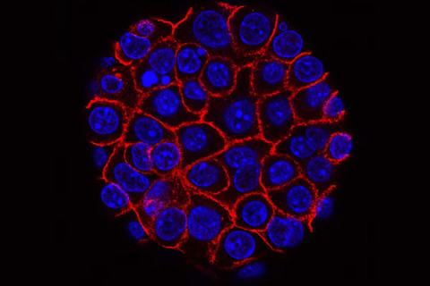 Cancer cells