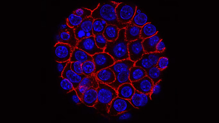 Cancer cells