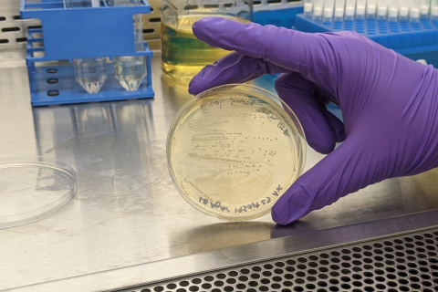 E Coli Culture