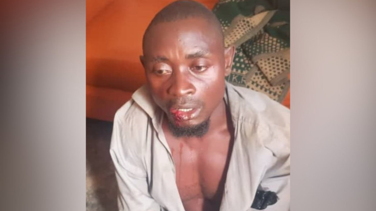 The Alleged Cannibal Shown After his Arrest