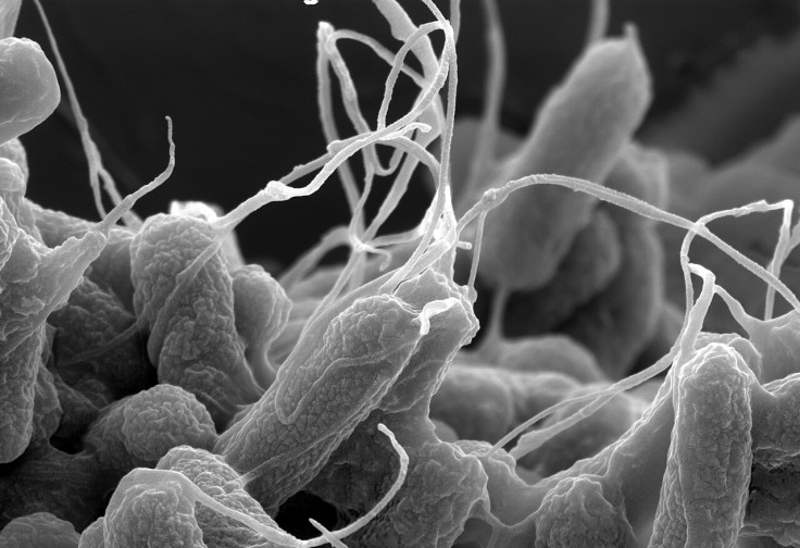 E.Coli