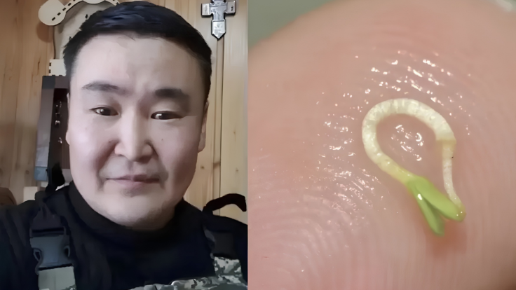 A germinating seed was found in a 42-year-old man's eye