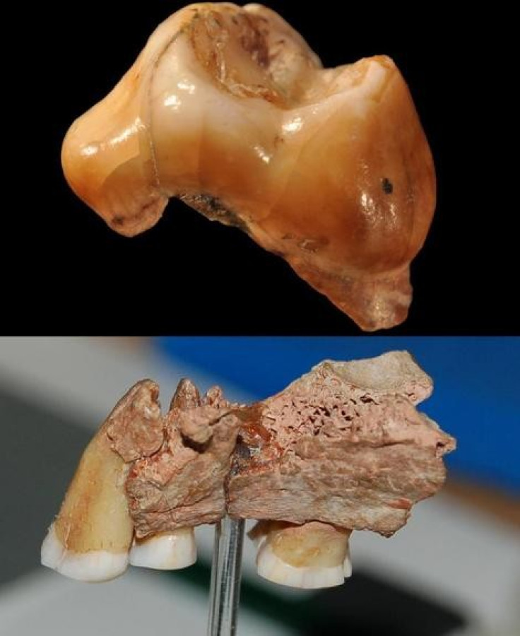 Jawbones with Teeth