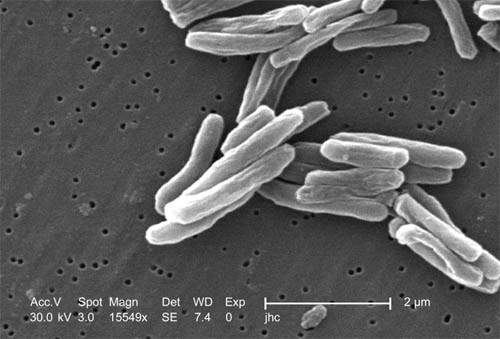 Tuberculosis Reaches Lowest Levels Since 1953 In U.S. Tuberculosis Reaches Lowest Levels Since 1953 In U.S.