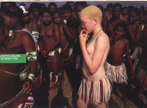 Albino