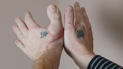 James Byrnes Thumbs