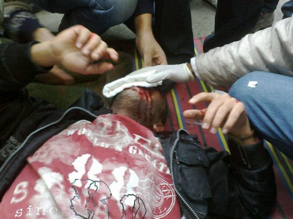 An OccupyCabinet protester being treated after being injured
