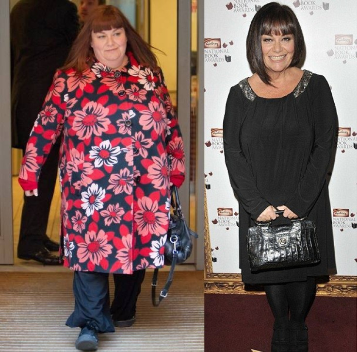 Dawn French