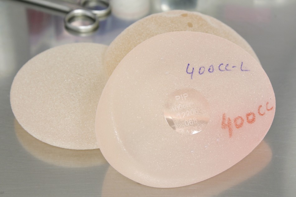 Silicone gel breast implant manufactured by PIP Silicone gel breast implant manufactured by PIP
