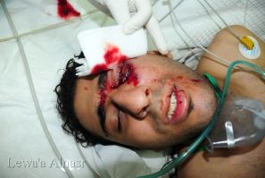 Bahraini protester bleeding from his eye after being injured by riot police, the Barhain Centre for Human Rights says