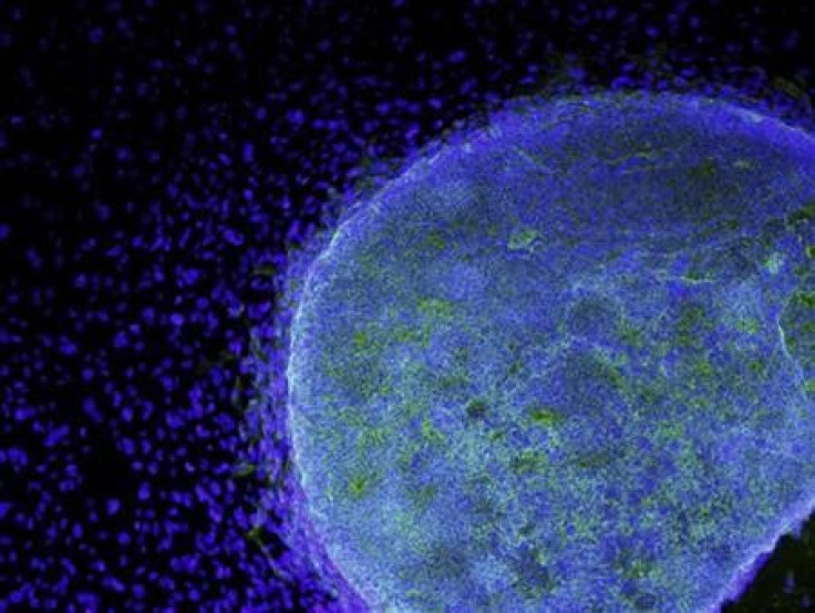 A microscopic view shows a colony of human embryonic stem cells (light blue) growing on fibroblasts (dark blue) in this handout photo released to Reuters by the California Institute for Regenerative Medicine, March 9, 2009.