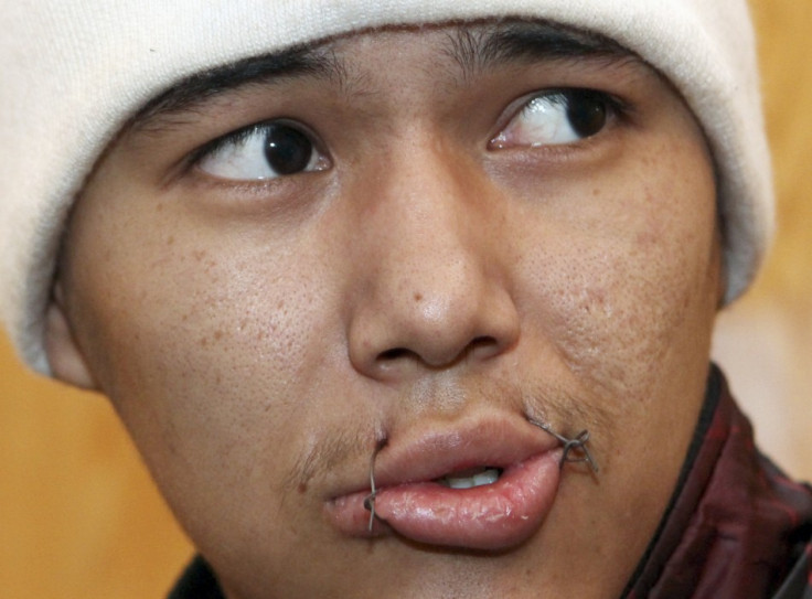 Kyrgyz prisoner's mouth sewn together for hunger strike