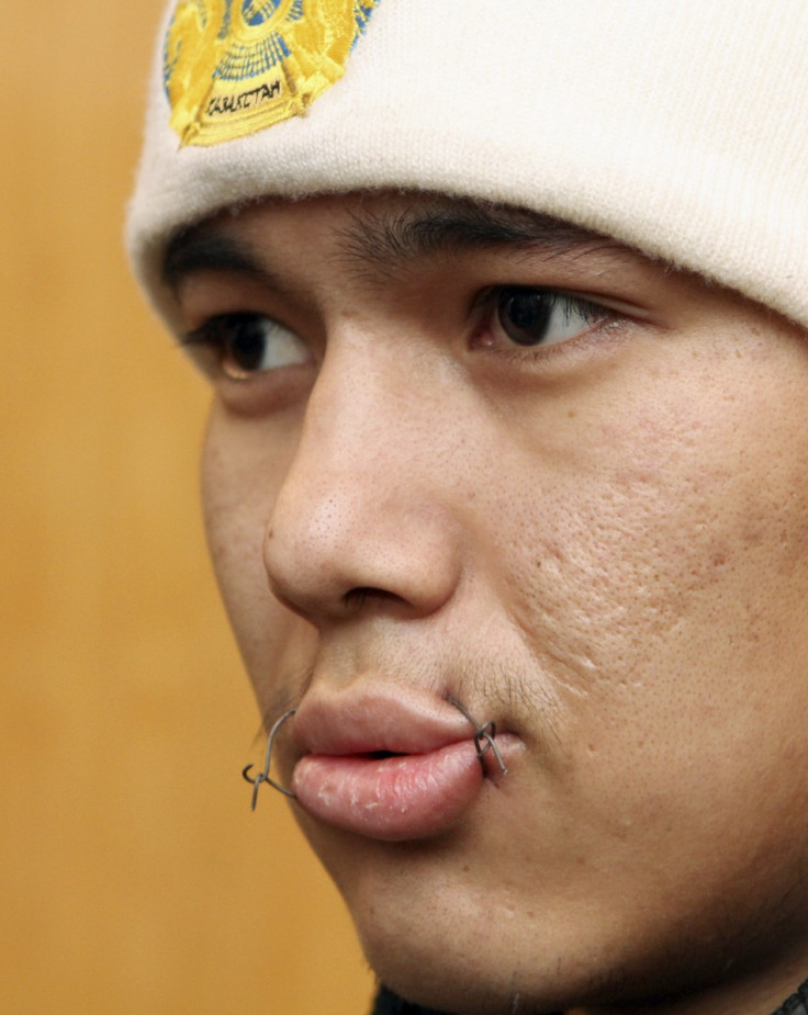 Kyrgyz prisoners can only take in fluids through their sewn-up mouths