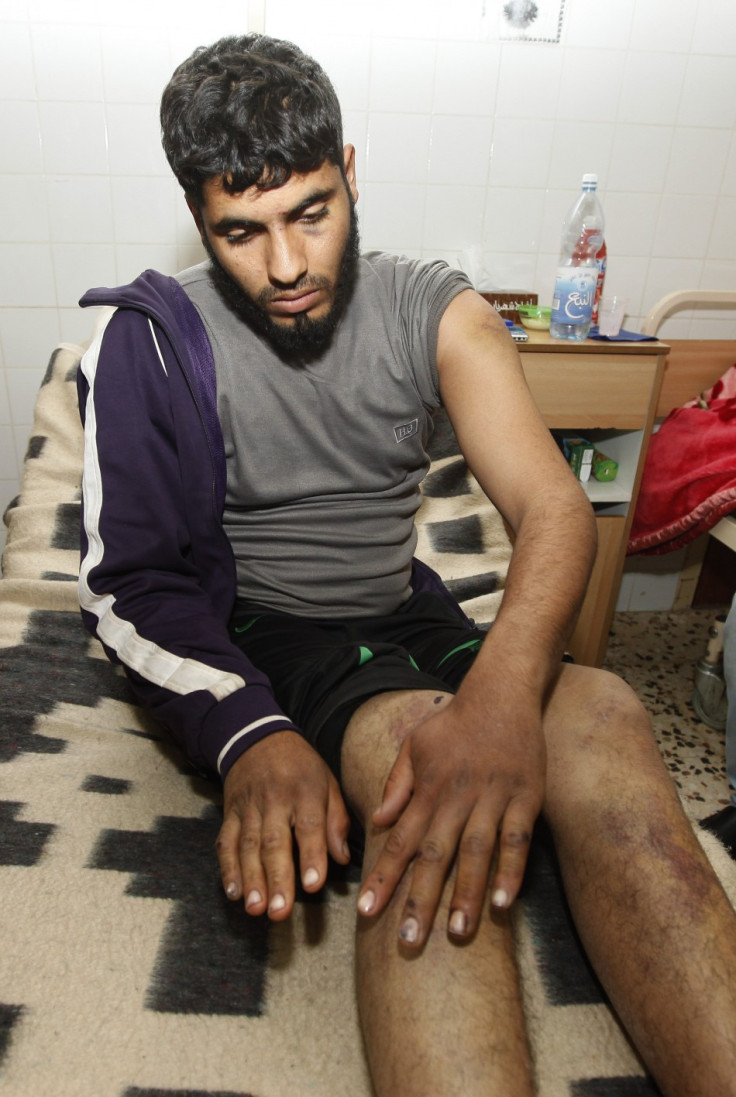 Ibrahim Mohammed from Assabia, who says he was tortured at the hands of the Gharyan city forces