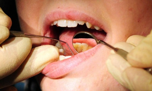 Bad Breath Can Helps Stem Cells Transform Into Liver Cells