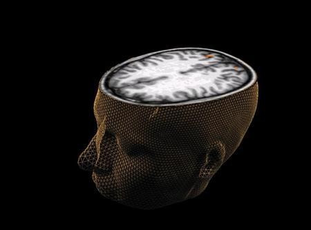 Brain