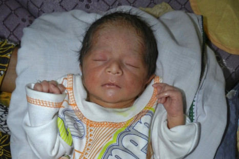 Six-Legged Baby Born Born in Pakistan