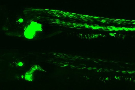 Green Glowing Zebrafish Provides Fresh Insights about the Hazardous Health Effects of Pollution