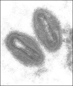 Quels sont les signes et les symptômes de Monkeypox ?