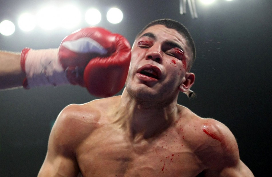 The Brutal Art of the Knockout Punch