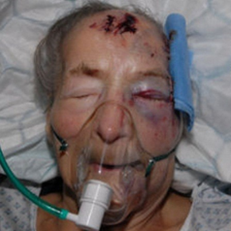 Emma Winnall, 94, was seriously injured in the attack at her home in Birmingham (West Midlands Police)