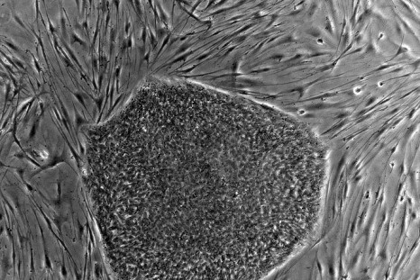 Scientists Find a Cure For leukaemia Patients