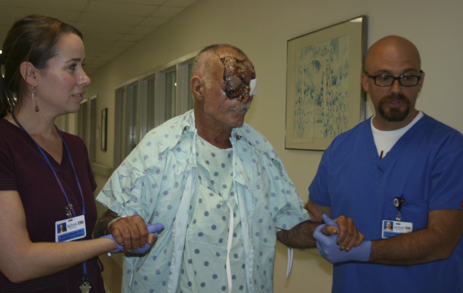 Miami face-eating attack victim Ronald Poppo is said to be recovering well is hospital (Reuters) Miami face-eating attack victim Ronald Poppo is said to be recovering well is hospital (Reuters)