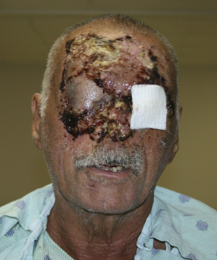 Jackson Memorial Hospital have released the first picture of Ronald Poppo recovering in hospital. (Reuters)