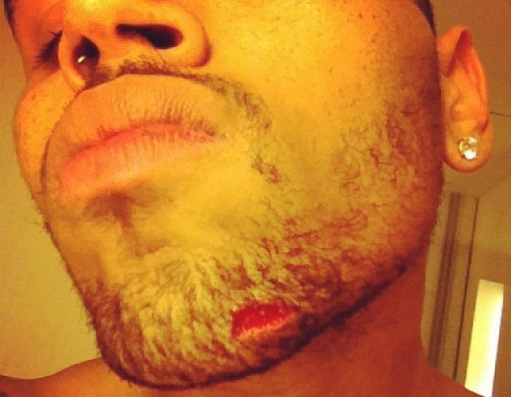 Chris Brown Hurt