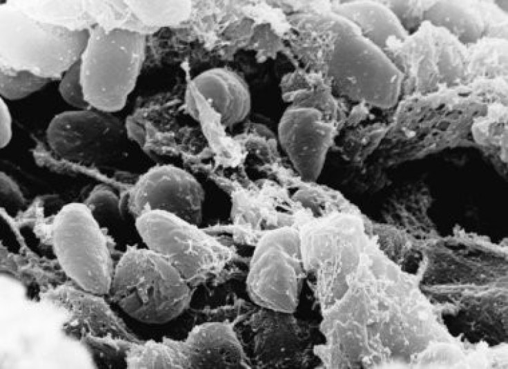 An Oregon man is in a critical condition with the plague (Rocky Mountain Laboratories)