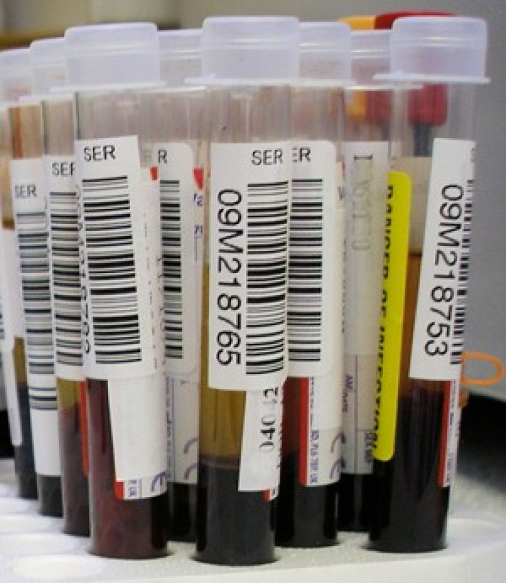 Post Surgery Blood Test Can Predict Death From Heart Problems