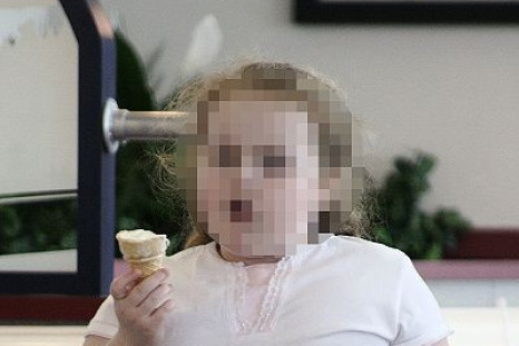 Obese child