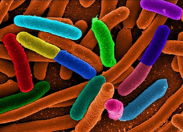 e coli